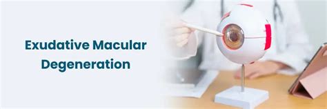 Effective Exudative Macular Degeneration Symptom Management