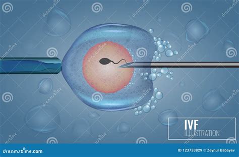 In Vitro Fertilization Injection. Artificial Insemination. Scientific ...
