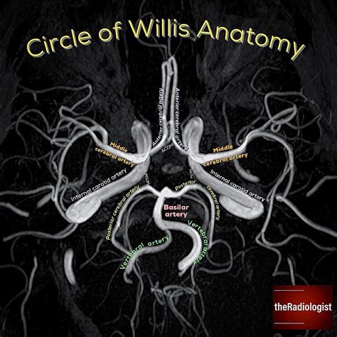 👨🏽‍💻Need a refresher on Circle of Willis anatomy? Check out this image from a 3D time of flight ... - circle of willis anatomy