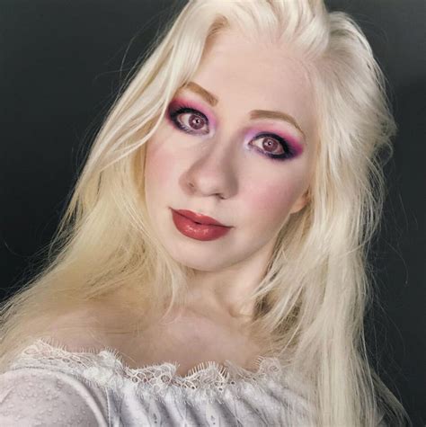 'People tell me I'm too bright to look at ,' says Albino woman with ...