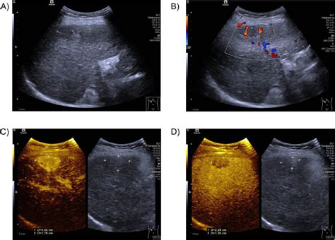 Image result for Ultrasound Lab