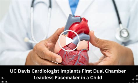 Dual Chamber Leadless Pacemaker Implantation Performed in Child by UC ...