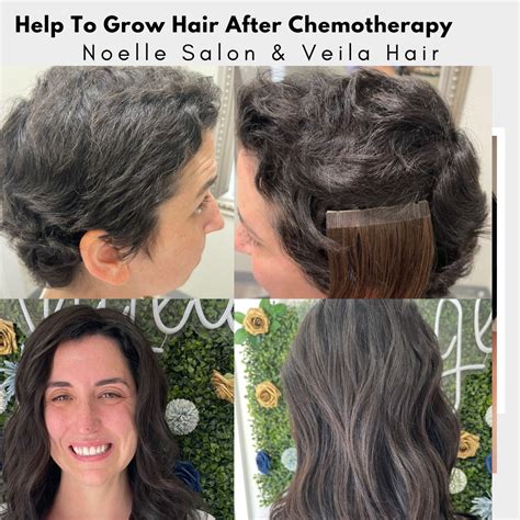 Help To Grow Hair After Chemotherapy | Noelle Salon