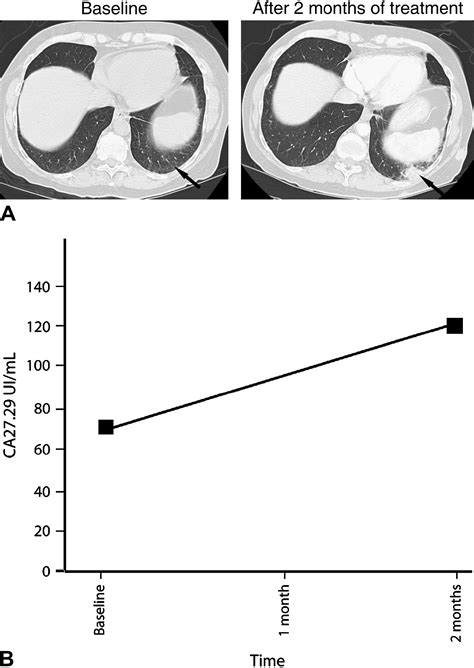 Increased cancer antigen 27.29 (CA27.29) level in patients with mycosis ...