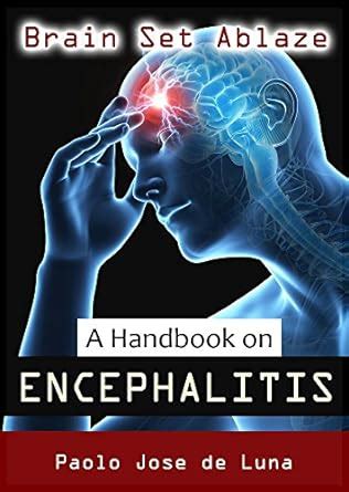 Brain Set Ablaze: A Handbook on ENCEPHALITIS eBook : de Luna, Paolo ...