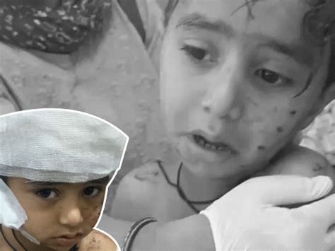 Bikaner: Stray Dogs Maul Boy on First Day of School