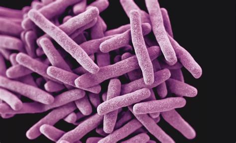 Endometriosis linked to infection with common bacteria - The Oxford Scientist