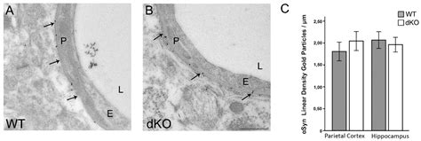 Uncoupling of the Astrocyte Syncytium Differentially Affects AQP4 Isoforms