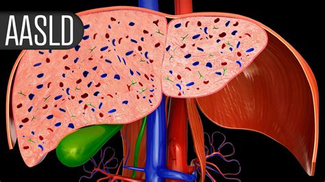 Saroglitazar for MASLD Cuts Liver Fat in Women With Polycystic Ovary ...