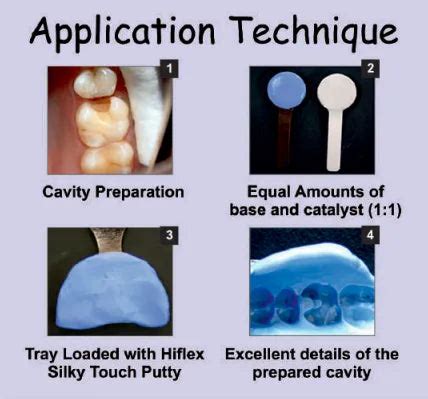 Buy Prevest Denpro Accusil Putty & Light Body – Oralkart