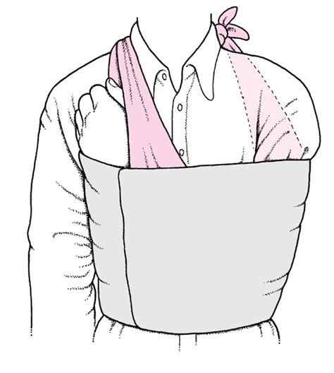 Shoulder Dislocations - Injuries; Poisoning - Merck Manual Professional ...