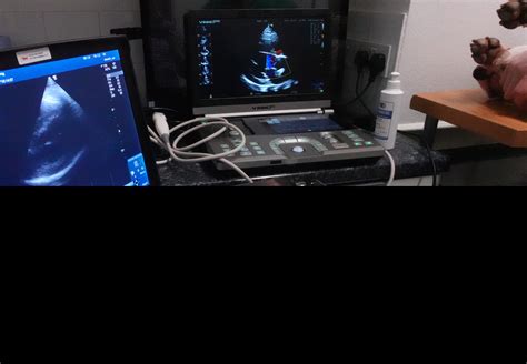 Vinno lead the way in portable ultrasound for 2025 - Portable Ultrasound Machines