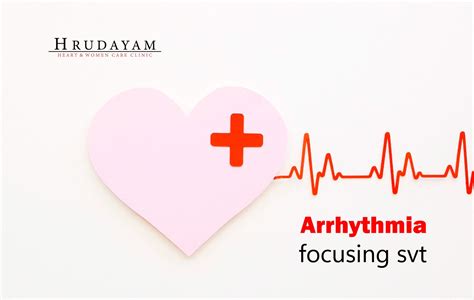 Arrhythmia Definition 的图像结果