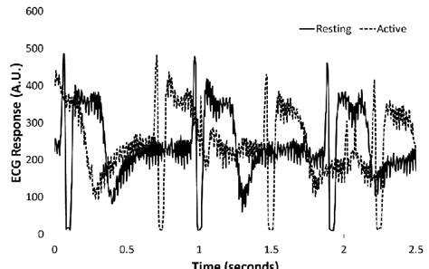 Image result for Microprocessor-Based ECG