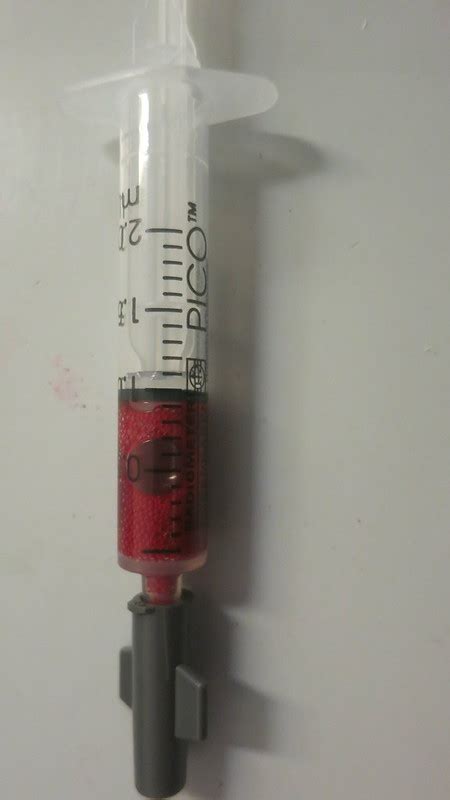 Image result for Normal Values in ABG Interpretation