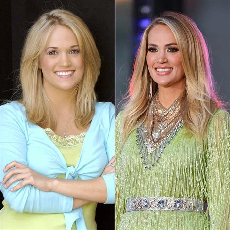Did Carrie Underwood Have Plastic Surgery On Her Face