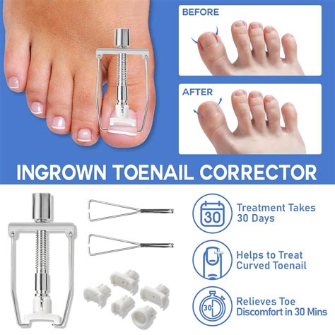 Xifepfr Professional Ingrown Toenail Treatment Kit - 110PCS, India | Ubuy