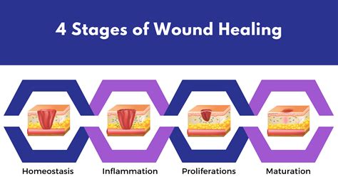 What Is Wound Care A Comprehensive Guide to Treatment and Healing