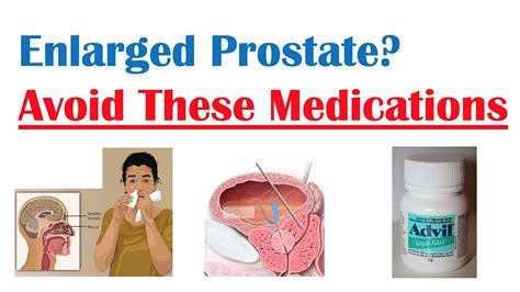 Image result for Enlarged Prostate Medication