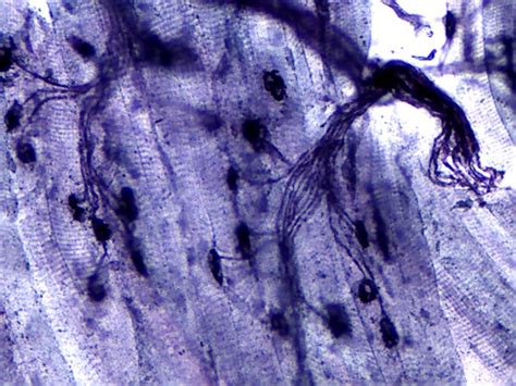 Course - Muscle Cell Structure and Function