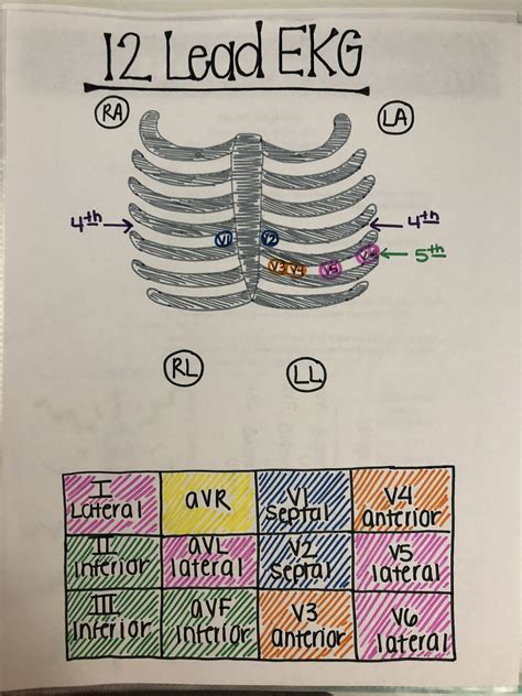 Ecg Nursing Mnemonics