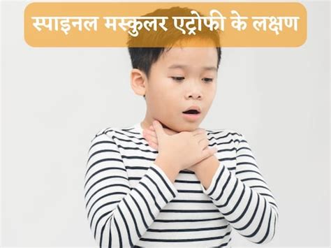 Spinal muscular atrophy- क्या है स्पाइनल मस्कुलर एट्रोफी, जिसके इलाज ...