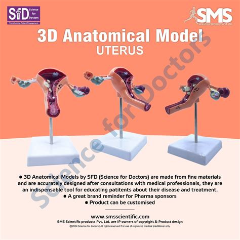 Uterus: 3D Anatomical Models – Science For Doctors