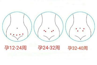 孕31周胎心位置图
