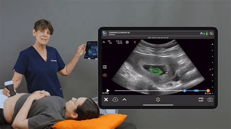 OB AI for Crown Rump Length (CRL) | Clarius