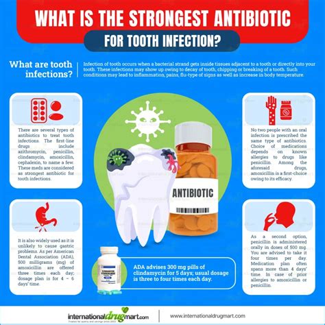 What is the strongest antibiotic for tooth infection? - InternationalDrugMart