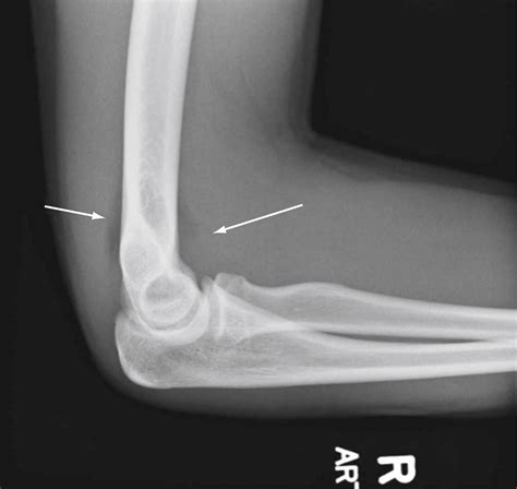 Emergency Care of Musculoskeletal Injuries - Clinical Tree