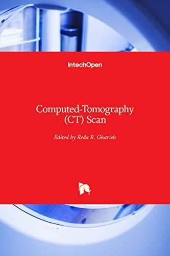 Buy Computed-Tomography (CT) Scan Book Online at Low Prices in India ...