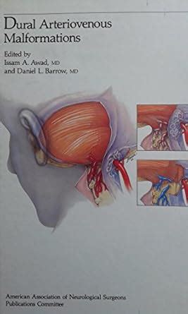 Buy Dural Arteriovenous Malformatio (Special topics series) Book Online ...