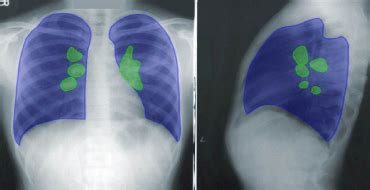 aiTouch - Data Science, Artificial Intelligence, Annotations, Analytics