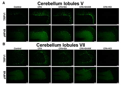 TRPV1 Responses in the Cerebellum Lobules V, VIa and VII Using ...
