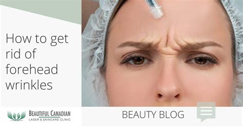 Surrey Forehead Wrinkle Treatments | How to Get Rid of Forehead Wrinkles