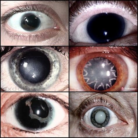 Image result for Iris Recognition Using MATLAB Source Code