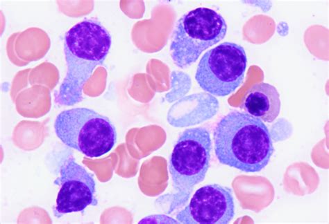 Plasma Cell Structure 的图像结果