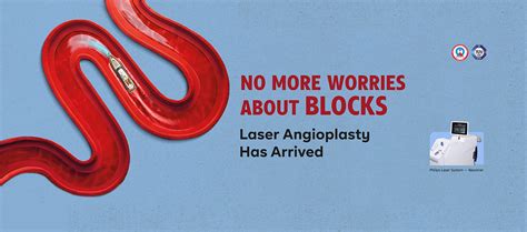 Best Heart Treatment- Top Hospital for Cardiac Surgery in Calicut ...