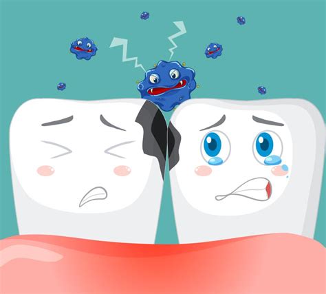 How To Fix Cavities Between Teeth? - Manadr