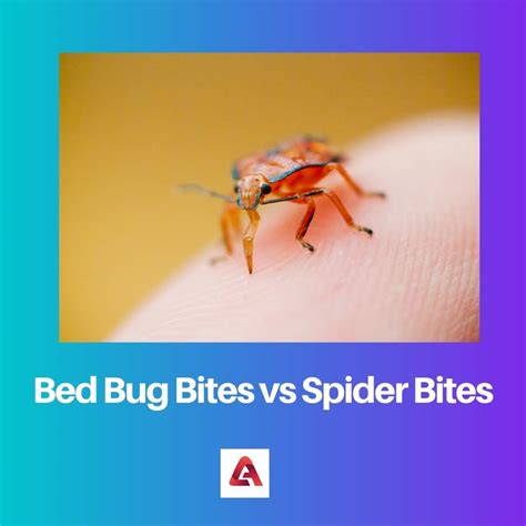 Bed Bug Bites vs Spider Bites: Difference and Comparison