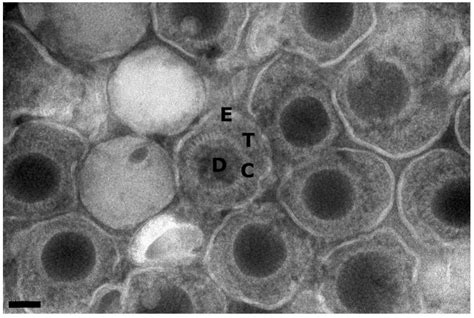The A, B, Cs of Herpesvirus Capsids