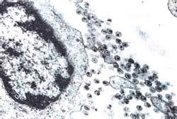 Anti-AIDS treatment aims at tolerating virus