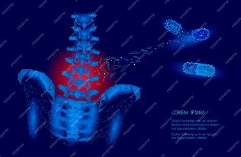 Human spine hip lumbar radiculitis pain low poly, geometric polygonal ...