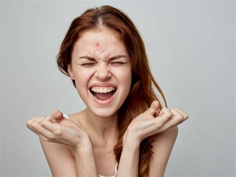 Skin Care: How to treat forehead acne and pimples effectively