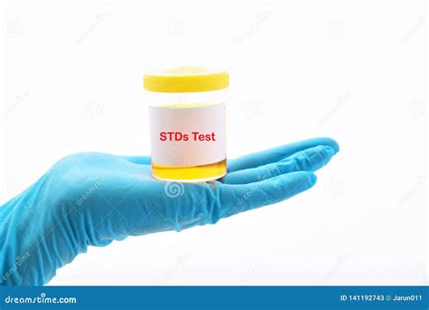 Can A Routine Urine Test Detect Stds at Kate Read blog