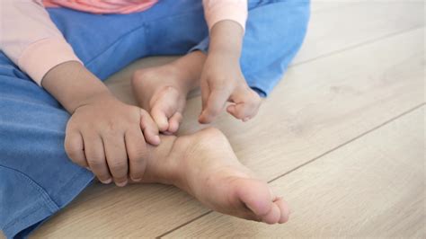 a kid suffering from itching skin on feet 46336423 Stock Video at Vecteezy