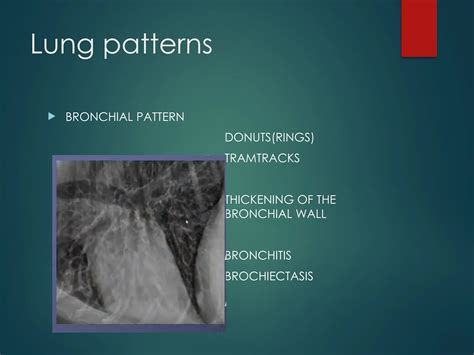 THORACIC RADIOGRAPH interpretation canine | PPTX