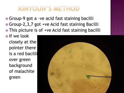 Image result for Acid-Fast Staining Method