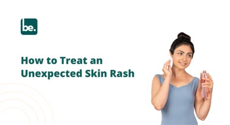 How to Treat an Unexpected Skin Rash – Belogical Wellness Private Limited